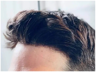 アップバングでもバレない