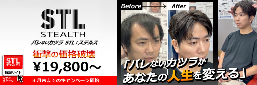  衝撃の価格破壊 ¥19800~ バレないカツラがあなたの人生を変える STL ステルス バナー