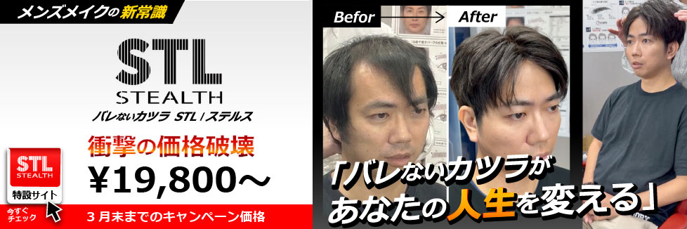 バレないウィッグ STL（ステルス）｜イケメン製作所