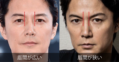 メンズ眉毛_眉間の広さの違い