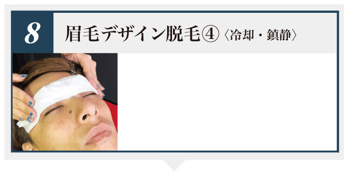 眉毛デザイン脱毛4 冷却・鎮静