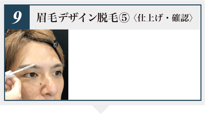 眉毛デザイン脱毛5 仕上げ・確認