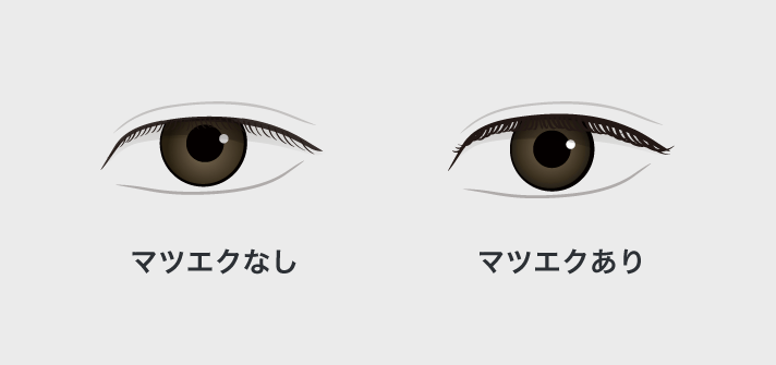 マツエクで2つの錯視効果が反映された目の対比イラスト