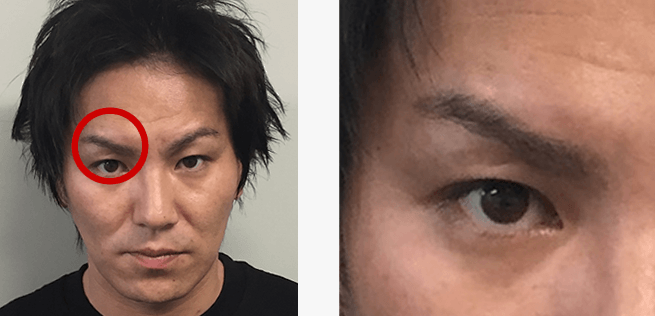 つり上がった細い「眉毛」の修正