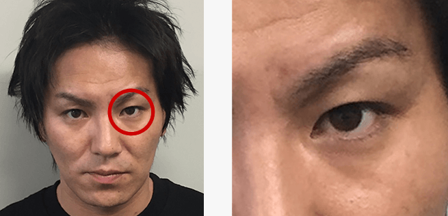 つり上がった細い「目」の修正